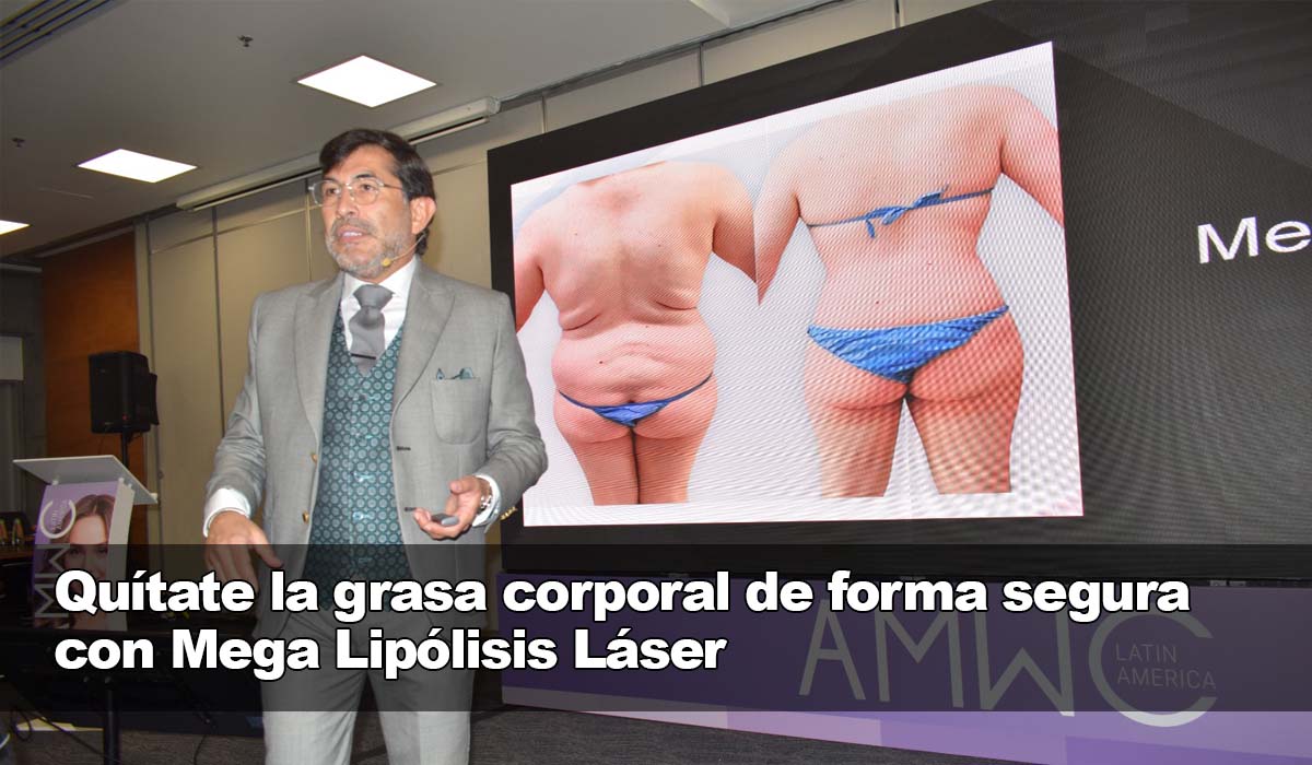Mega Lipólisis Láser para eliminar la grasa corporal de forma segura y efectiva