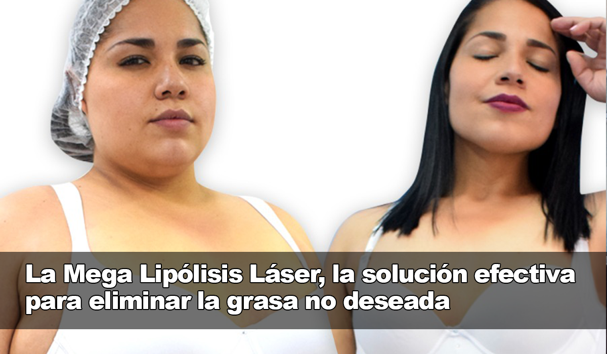 La Mega Lipólisis Láser, la mejor alternativa para diluir la grasa sin preocupaciones